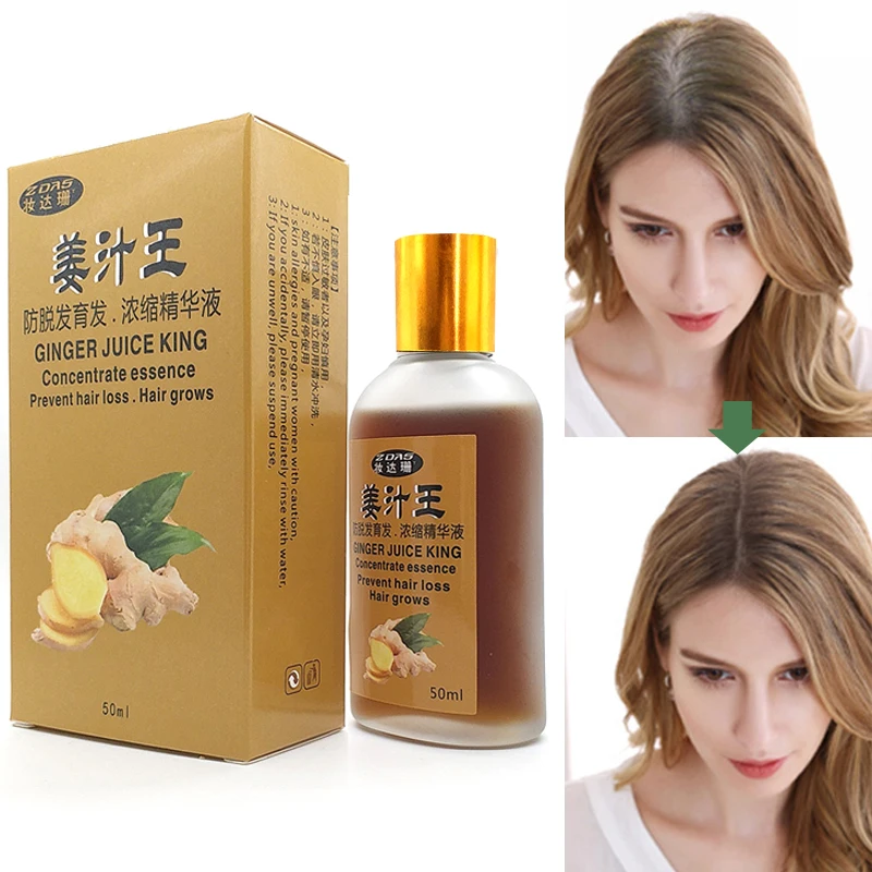 Hair Loss Product hair care Rapid effects postpartum Seborrheic alopecia Restorer medicine
