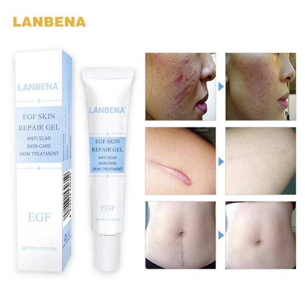 Queimador de Gordura Perda de Peso Novo Corpo Emagrecimento Creme Anti Celulite Cremes Perna Cintura Eficaz Gordura Queima 227g 2021 4 Tratamentos esfoliantes e p/ corpo