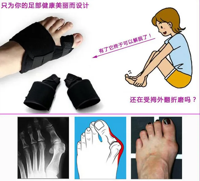 1 пар/лот вальгусная деформация pro коррекция носка большой палец лента физическая обезболивающая большая кость корректор пальца магнитный пояс