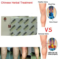 2 шт. высокое качество варикозное расширение вен лечение патч васкулит травяные лечения кислот Bilges зуд Пластырь от боли Pacth