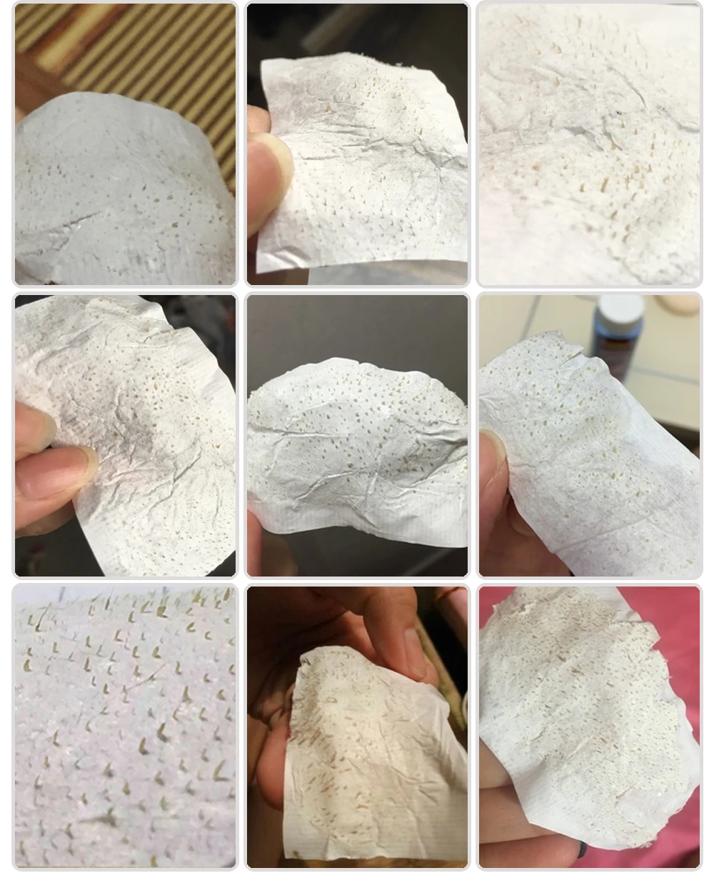 Removedor de Cravo Tratamento da Acne Controle de Óleo de Limpeza Descamação Máscara Lanbena Nariz Pore Faixa Preta Profunda Facial 5 Pcs 11 Da Acne Controle de Óleo de Limpeza Profunda Máscara Facial