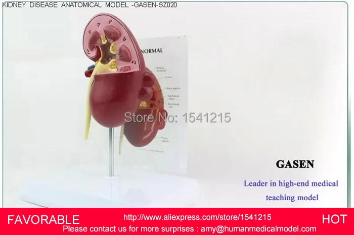 HUMAN KIDNEY ANATOMICAL MODEL URINARY SYSTEM MEDICAL SCIENCE TEACHING SUPPLIES HUMAN ANATOMICAL STEREO MODELL-GASEN-SZ020