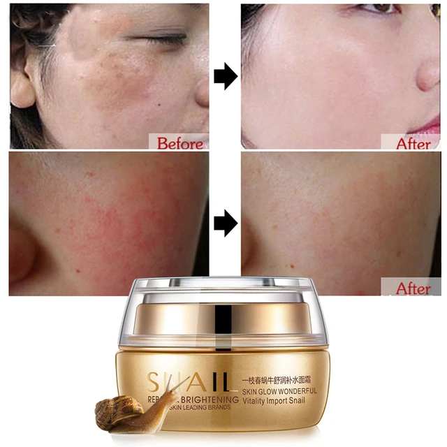 Moisturizing Face Cream Scar Remove creme Age Spot Pigment Whitening