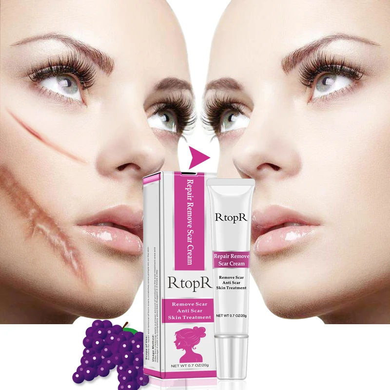 

RtopR Acne Scar Repair Cream Acne Spots Treatment Blackhead Whitening Cream Hrink Pores Whitening Moisturizing Cream TSLM1
