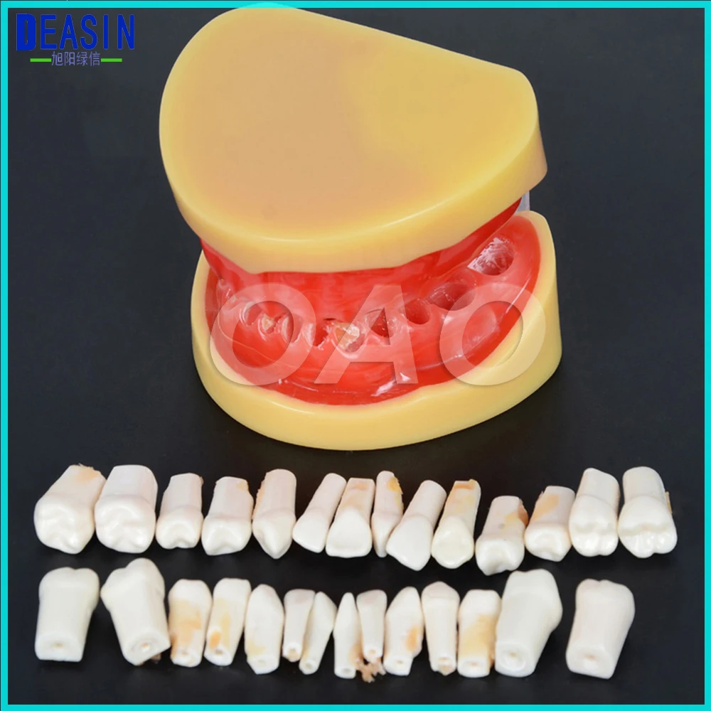 Dental All Teeth Removable Standard Teeth Tooth Model 28 PCS Teeth Student Learning Model Dental All Teeth Removable Standard Teeth Tooth Model 28 PCS Teeth Student Learning Model