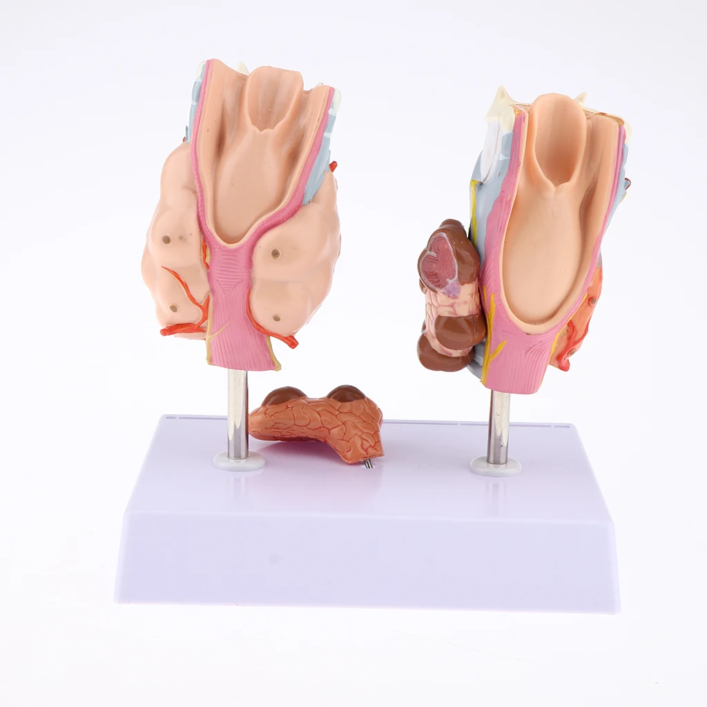 Magnified Human Thyroid Anatomical Model Normal & Diseased With Pathologies For Classroom Study Display Teaching