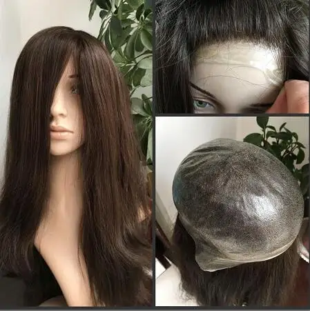 Система волос для женщин. Парики системы замещения волос. Парик на силиконовой основе. Система замещения волос для женщин. Парики системы замещения волос.