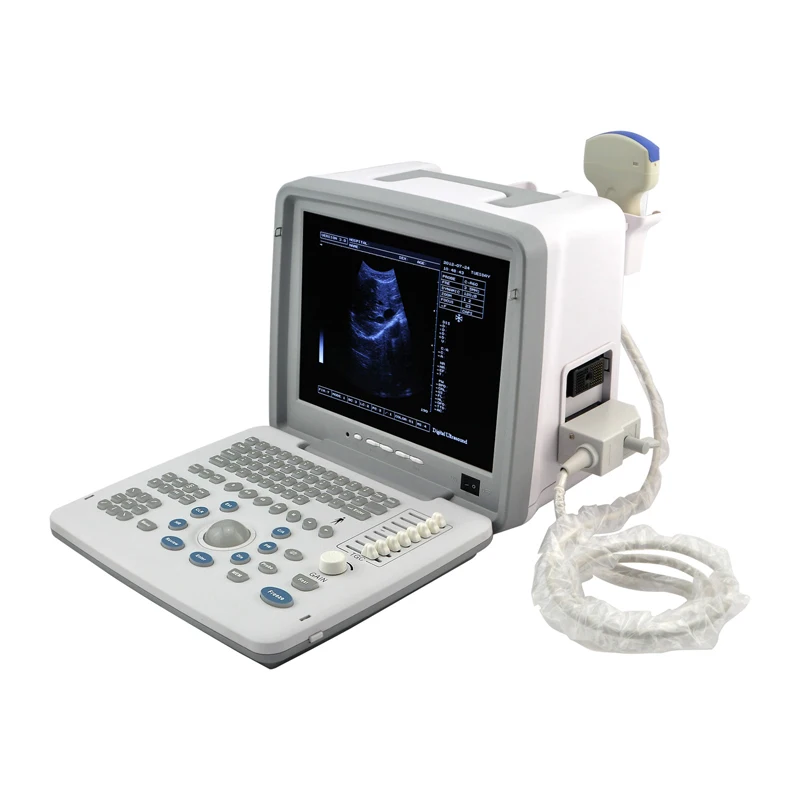 

12 in LED screen portable ultrasound free shipping