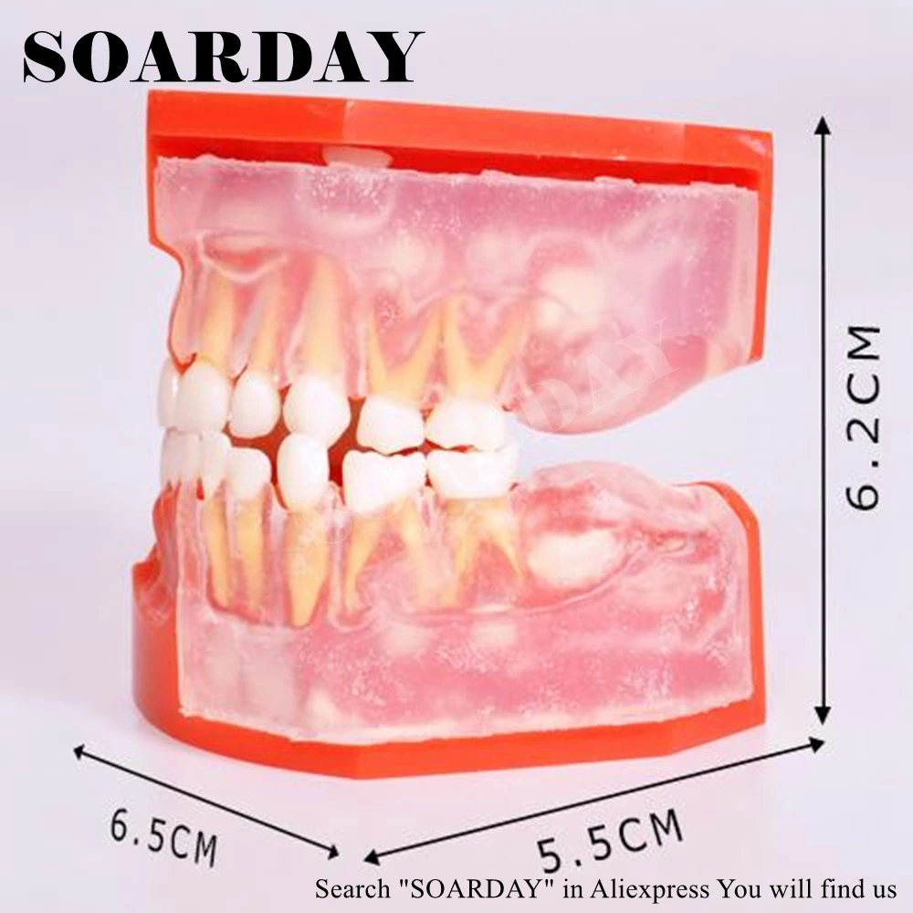 SOARDAY молочных зубов Альтернативная модель для 3-6 лет ребенок показывает извержение основной и постоянные зубы развития