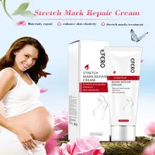 40 г стрейч-марка для беременных, сыворотка для беременных, растягивающиеся маркеры, крем от прыщей, уход, гладкие кремы для кожи, Послеродовая сыворотка