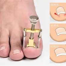 Инструмент для фиксации вросших пальцев ног, инструмент для фиксации, инструменты для фиксации ног, инструменты для фиксации ногтей Ingro wn 70