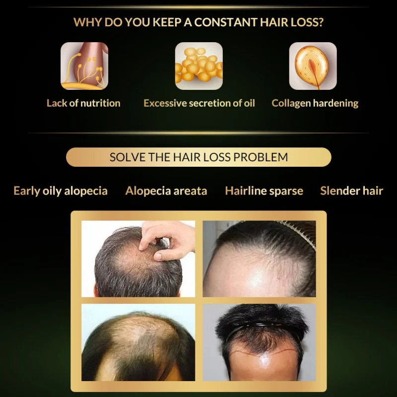 Рост волос Essential масляная эссенция оригинальные аутентичные 100% от выпадения волос жидкие красивые, густые роста волос