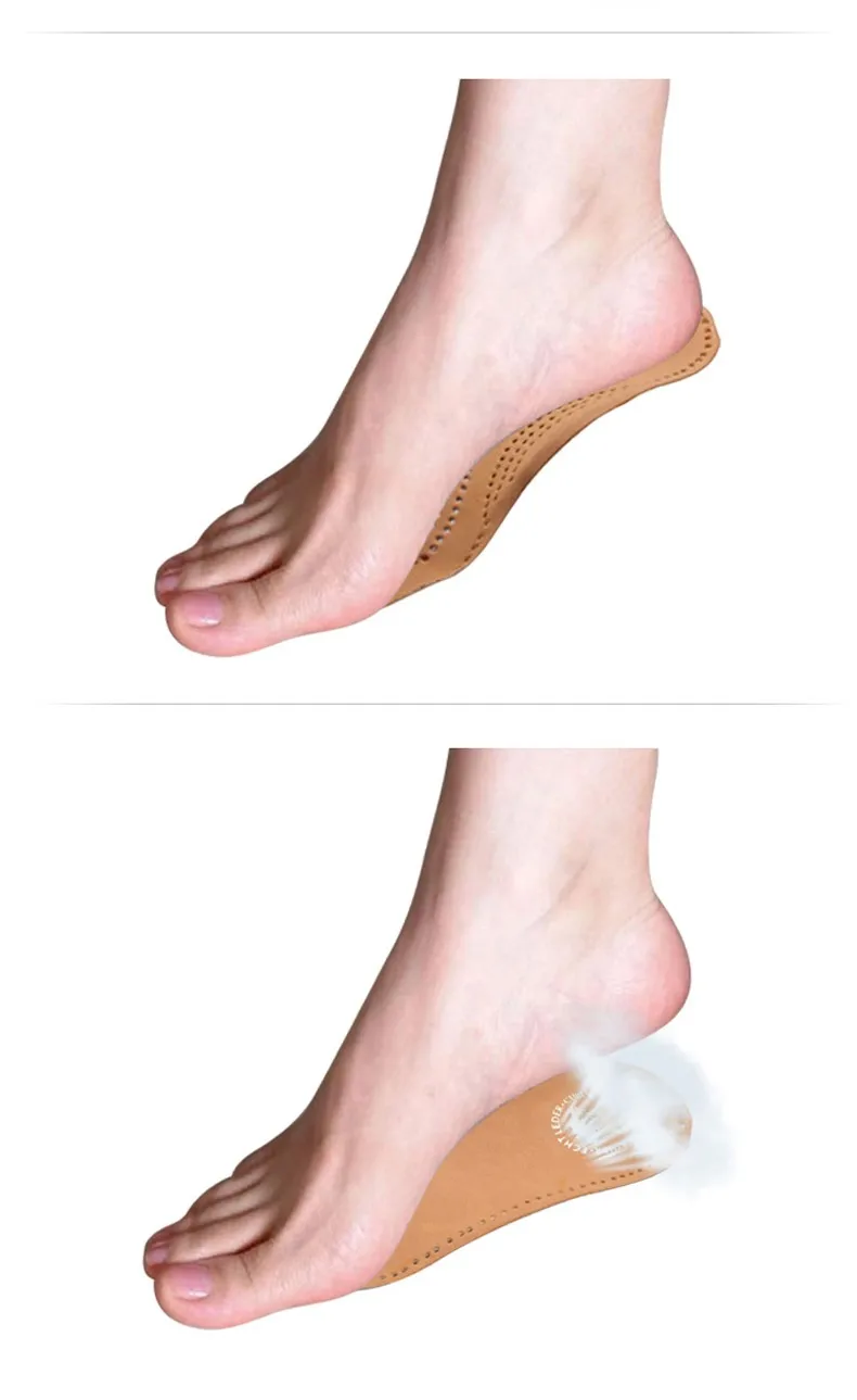 3 4 Orthopedic Half Insoles Arch Support Damping Flat Foot Protective X-Leg Correction Men Women Shoes Pads Cowskin Shoe Inserts (3)