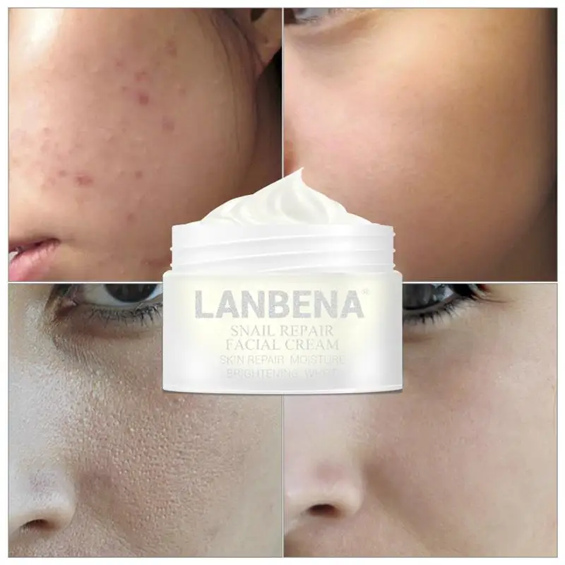 

LANBENA Snail Cream Whitening Face Cream Anti Wrinkle Anti Aging Acne Treatment Moisturizing Firming 30g Skin Repair Daily Care