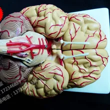 Анатомическая модель мозга церебральная артерия анатомическая модель нейрология модель головного мозга