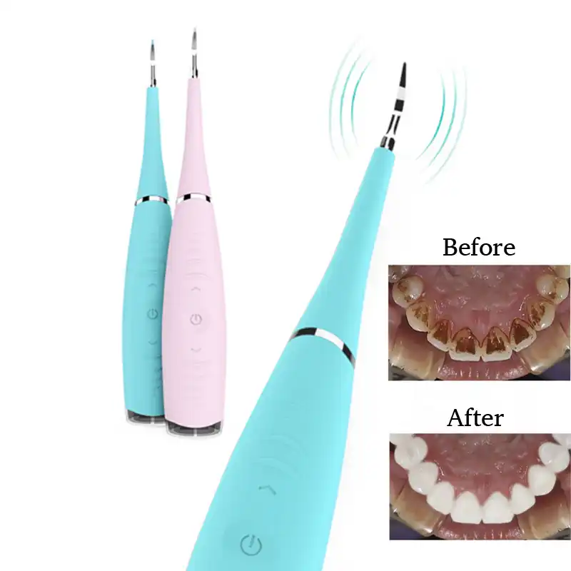 Teeth whitening Home Use Tooth Stain Remover Tartar Teeth Stains