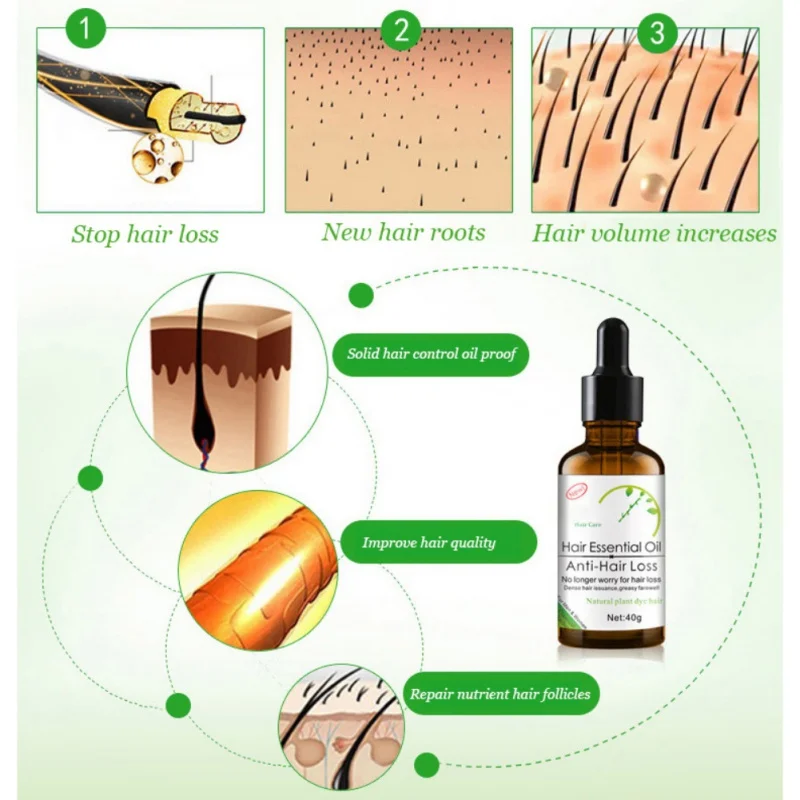 Эфирные масла для роста волос эссенция подлинный выпадения волос жидкий уход за здоровьем плотная Сыворотка от выпадения волос Горячая