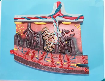 

Placental Tissue Enlargement Model Human Placenta Tissue Zoom Model Uterine Blood Vessels Amniotic Membrane Dissection Anatomy