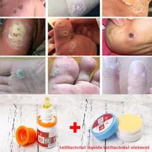 Уход за ногами медицинский пластырь бородавок для удаления мозолей ног подошвенные бородавки шип пластырь для снятия боли бородавка жидкость для удаления бородавки 15 г