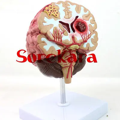 

Human Anatomical Brain Disease Professional New Anatomy Medical Teach Model School Hospital