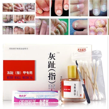 

25g Anti Fungal Nail Infection Toe Nails Fungus Treatment Yellow Essence Removal Nail Care Clear Fungus Plasters D232