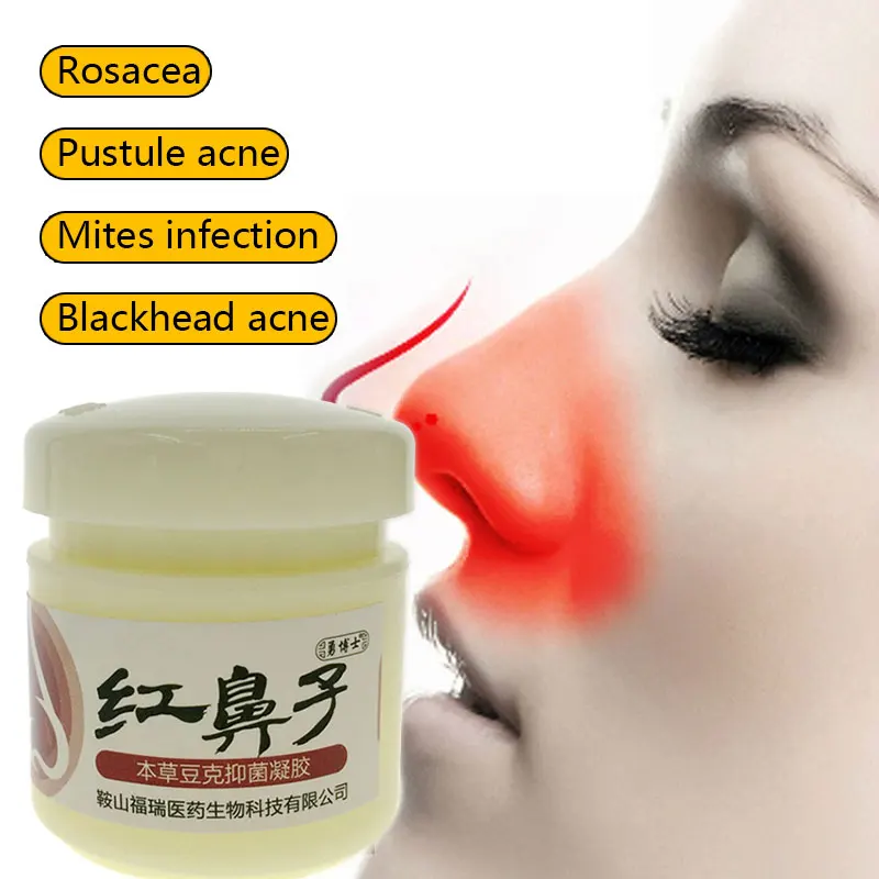 Rosacea Cream Red Nose Ointment Remove Blackhead Acne Cream Skin Care