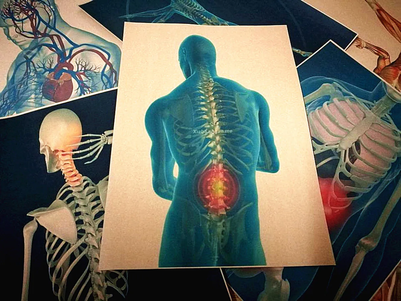 3D X ray сканирование человека анатомия ретро Kraft бумажные плакаты Скелетное