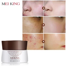 12015 MEIKING Hot Beauty Moisturizing Face Cream Water Whitening Moisturizing Face Cream Suitable For All Skin Types MS-5019YR 12015 MEIKING Hot Beauty Moisturizing Face Cream Water Whitening Moisturizing Face Cream Suitable For All Skin Types MS-5019YR