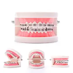 Зубные Ортодонтического Зубы модели с Орто металлические Керамика кронштейн АРКА провода щечной трубки модель обучения Ортодонтические