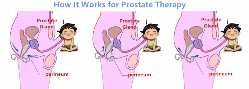 Pulse Magnetic Prostate Glands Massaging Therapy Device Prostate Massager Vibrating Treatment Machine Medical Silicone Materials (1)