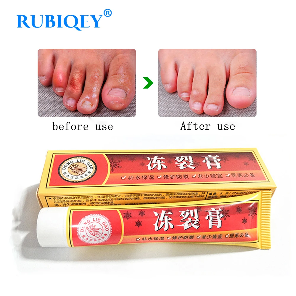 

Powerful Hand Foot Crack Cream Heel Chapped Peeling Foot and Hand Repair Anti Chapping Wrinkle Treatment Skin Cracking (no box)
