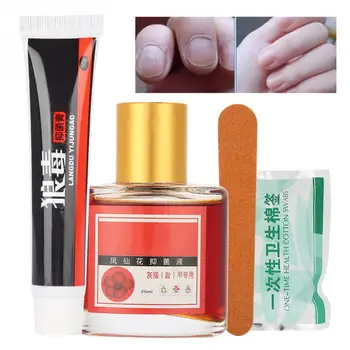 

Fungal Nail Treatment Feet Care Anti Fungus Onychomycosis Nail Repair Treatment Balsam Liquid Care Nail Regeneration Cream