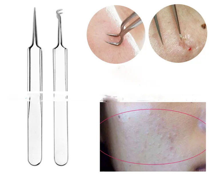 Ferramenta de Limpeza Beleza da Pele Sets Atacado - Set Removedores Blackhead Blemish Pimple Extractor Removedor Agulhas Facial Cuidados 100 4 Pçs 7 Blackhead Blemish Pimple Extractor removedor Agulhas Ferramenta