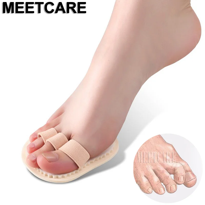 1 Pair Toes Overlap Hammer Toe Correction Pad Soft Bunion Splint ...