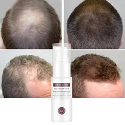 Средство для роста волос эфирное масло жидкий спрей питает корни толстые блестящие от выпадения волос анти-волосы для мужчин и женщин