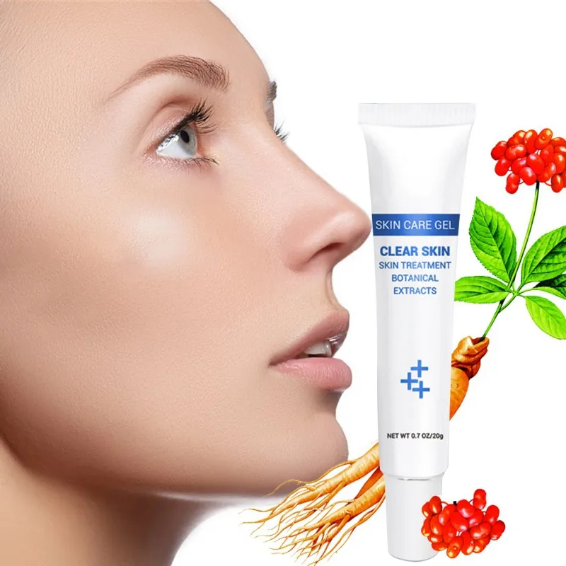 Acne Cleaning Cream Skin Care Remove Repair Pimple Acne Quickly Face