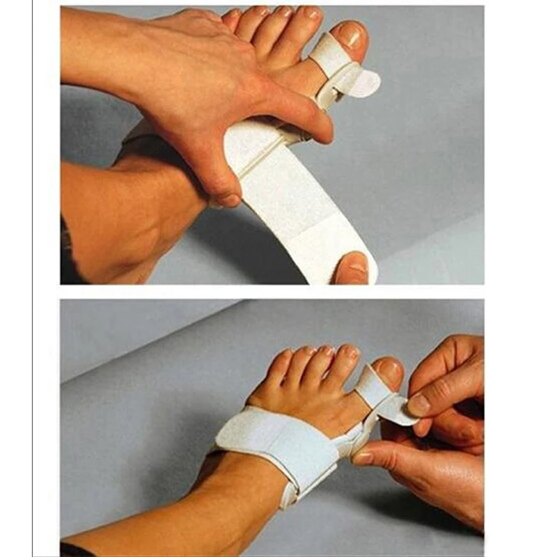 1 Pair Toe Separator Hallux Valgus Correction 24 Hours Bunion Orthotics Enhanced Adjuster Big Toe Corrector Orthotics Feet Care 1 Pair Toe Separator Hallux Valgus Correction 24 Hours Bunion Orthotics Enhanced Adjuster Big Toe Corrector Orthotics Feet Care