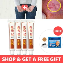 4 шт. крем от геморроя лечение акне Анальная фистула боль китайский пластырь для внутреннего геморроя груды внешняя Анальная мазь