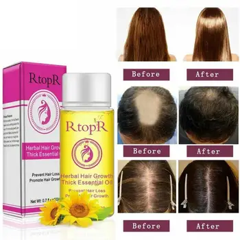 

20ml Fast Powerful Hair Growth Products Organic Essential Oil Liquid Treatment Preventing Hair Loss Dry Hair Care Oil