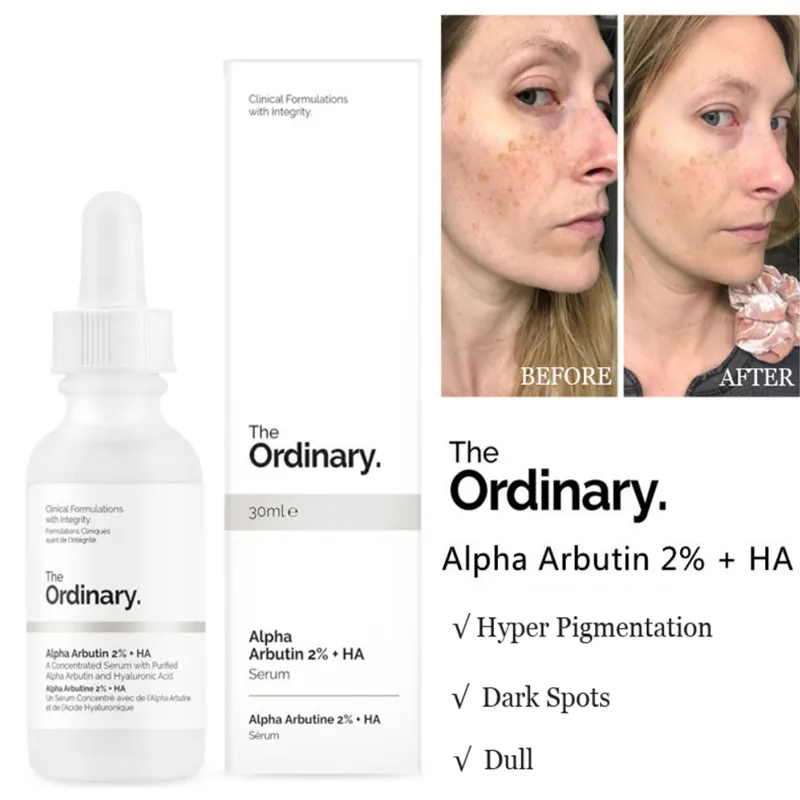

The Ordinary Alpha Arbutin 2% + HA 30ml Concentrated Whitening Face Serum Remove Dark Spots Freckle Hyper Pigmentation