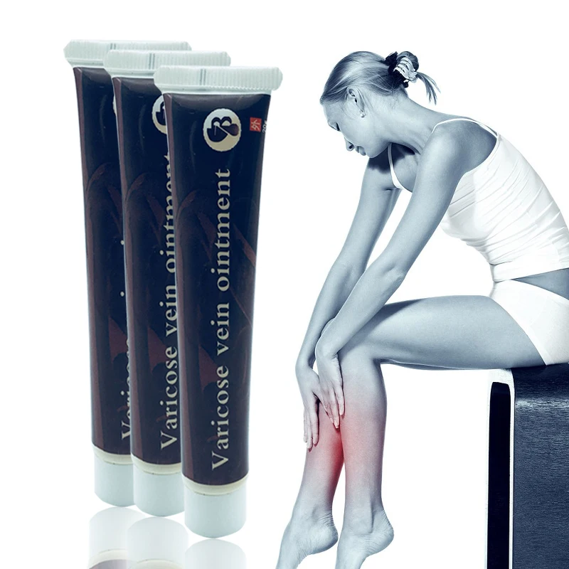 الدوالي كريم علاج فعالة علاج التهاب الأوعية وريدي العنكبوت الأوردة الألم دوالي Angiitis مرهم الرعاية الصحية