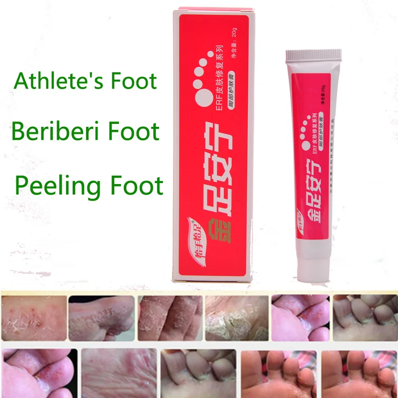 Crack Heel Cream Repair Anti Crack Whitening Cream Foot Peeling Cracked