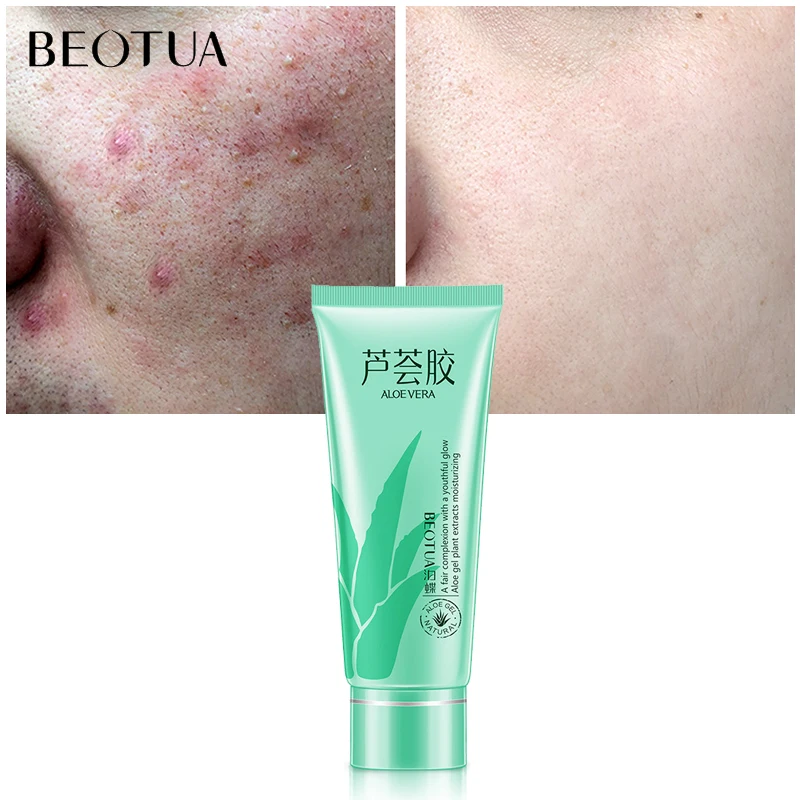 

BEOTUA Aloe Vera Smooth Gel Hyaluronic Acid Anti-Aging Face Cream Treatment Acne Brighten Repair Skin Moisturizing Sleeping Mask