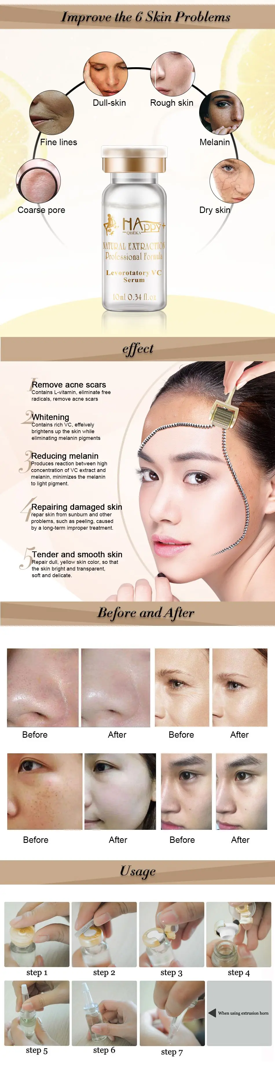 VC2