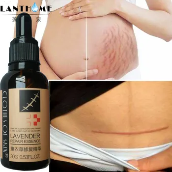 

Lavender Extract Stretch Marks Remover Cream Serum,Maternity Skin Repair Oil Repair Surgical Scar/burn Marks/Acne Essence Care