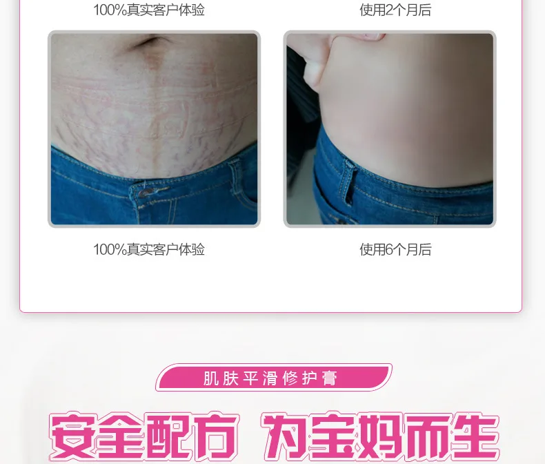 TYJR Stretch Marks Cream Remover Skin Repair Moisturizing Anti Wrinkles Firming Skin Pregnancy Cream Maternity Body Skin Care