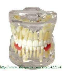 dental model 46