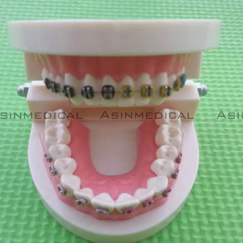 

2016 Dental Orthodontic Study Teeth Model With Metal Brackets Simulation Teeth Model teeth