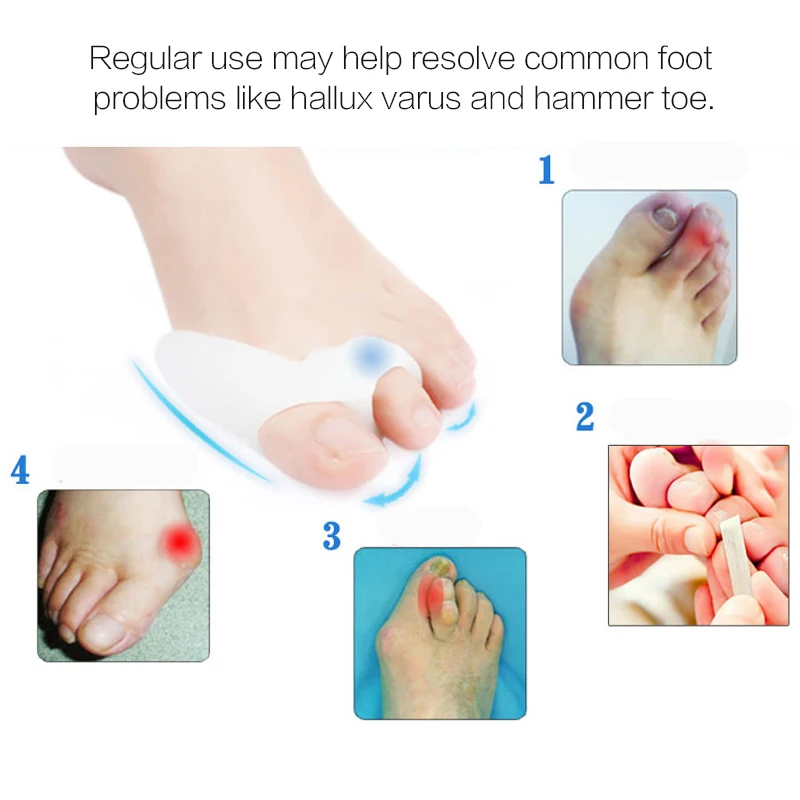 Hot Toe Seperating Gel Pedicure Shield Toe Separators Stretchers Bunion Protector Straightener Corrector Foot Care Hallux Valgus Hot Toe Seperating Gel Pedicure Shield Toe Separators Stretchers Bunion Protector Straightener Corrector Foot Care Hallux Valgus