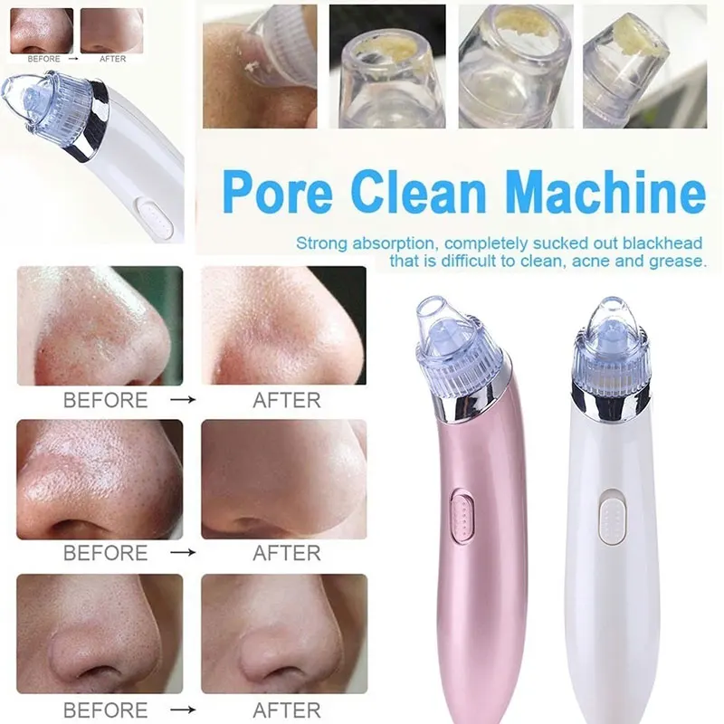 

Fast Cosmetic Instrument Blackhead Removal Equipment Clear Beauty Health 2 Color Black Head Cleaner Effective ABS